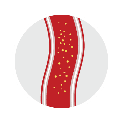 Zdrava arterija